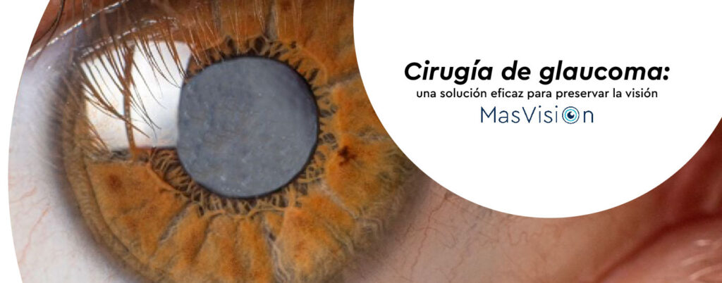 Cirugía de glaucoma en Medellín | Clínica MasVision
