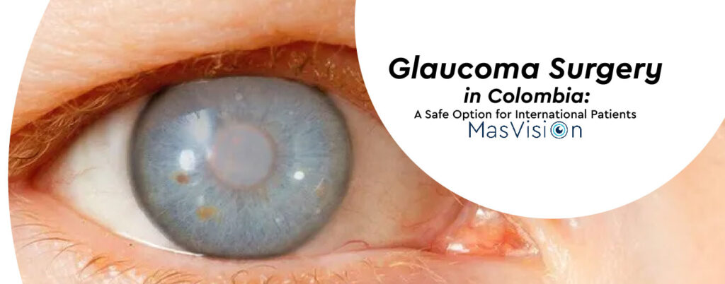 Glaucoma Surgery in Colombia: A Safe Option for International Patients