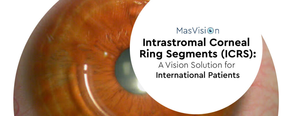 Intrastromal Corneal Ring Segments (ICRS): A Vision Solution for International Patients