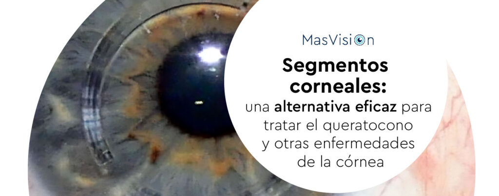 Segmentos corneales: cirugía para restaurar la visión