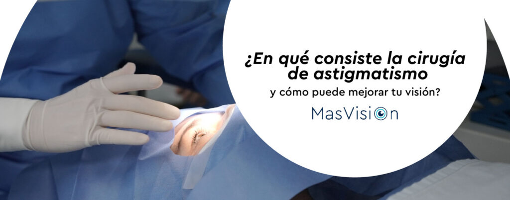 ¿En qué consiste la cirugía de astigmatismo y cómo puede mejorar tu visión?