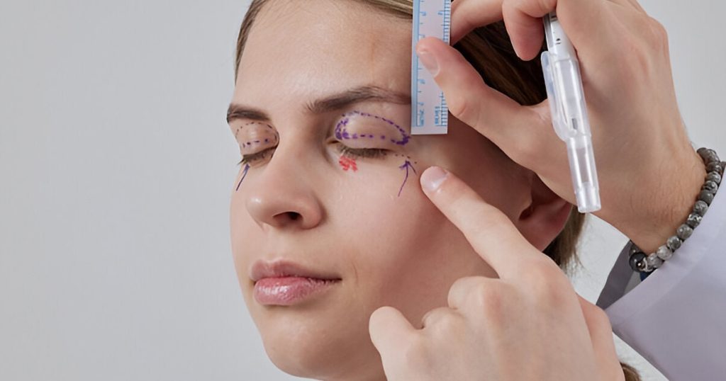 Why Blepharoplasty at MasVision Is a Smart Choice for Int