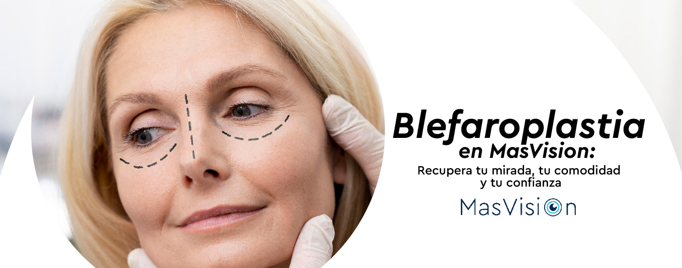 ¿Qué es la blefaroplastia y por qué es tan solicitada?